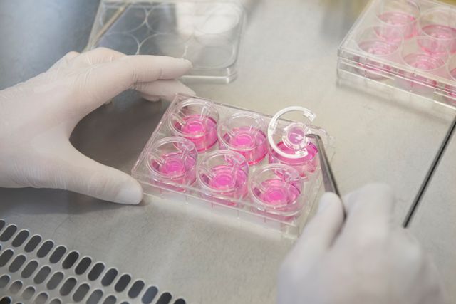Im Labor hergestellte Hautmodelle dienen als Ausgangspunkt für die Weiterentwicklung eines Testsystems für Immuntherapeutika gegen das maligne Melanom. Im Labor hergestellte Hautmodelle dienen als Ausgangspunkt für die Weiterentwicklung eines Testsystems für Immuntherapeutika gegen das maligne Melanom.