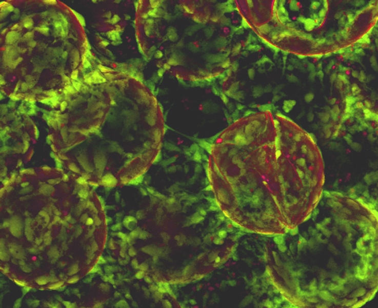 Humane induzierte pluripotente Stammzellen (hiPS) auf Mikrocarriern 