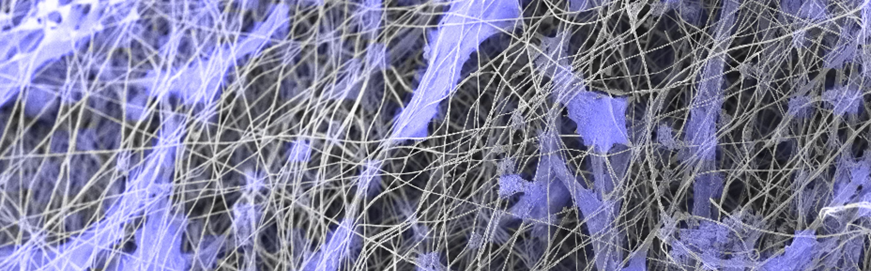 Fibers Fibroblasts