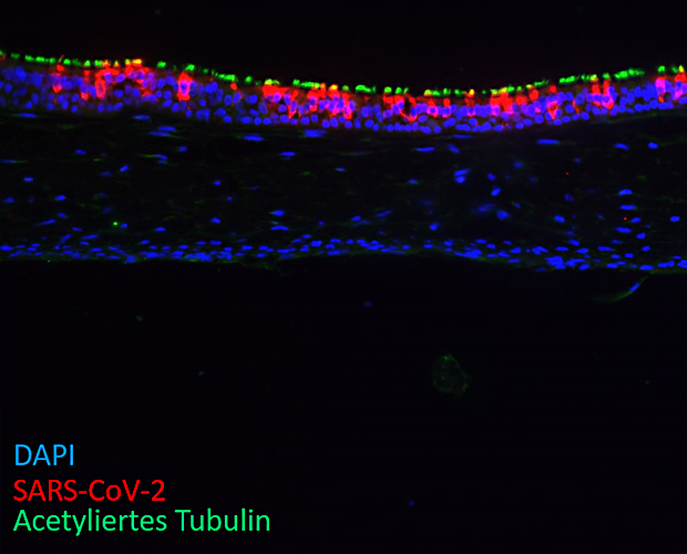 In-vitro infection model SARS-CoV-2