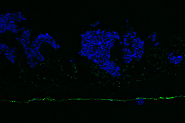 Endothelial cell barrier