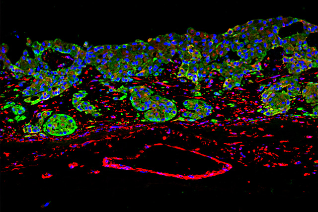 In-vitro Tumourmodel