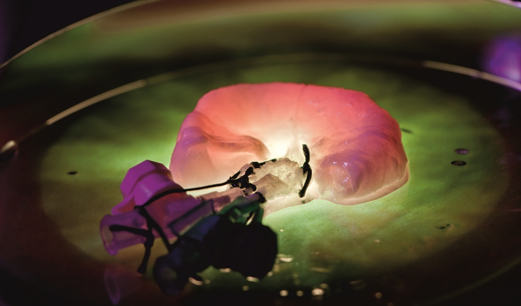 BioVaSc<sup>®</sup>: biological vascularized scaffold for tissue engineering applications.