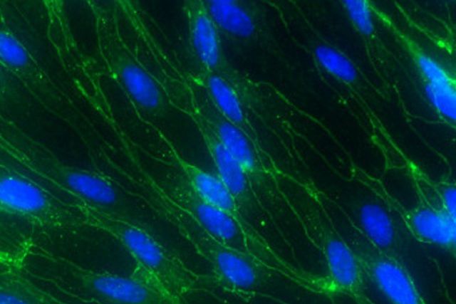 Protecting the brain from pathogens, toxins or other harmful substances is one major function of the blood-brain barrier.  This is ensured by tight junctions between endothelial cells (green); cell nuclei are shown in blue.